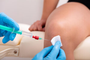 Prolozone Therapy